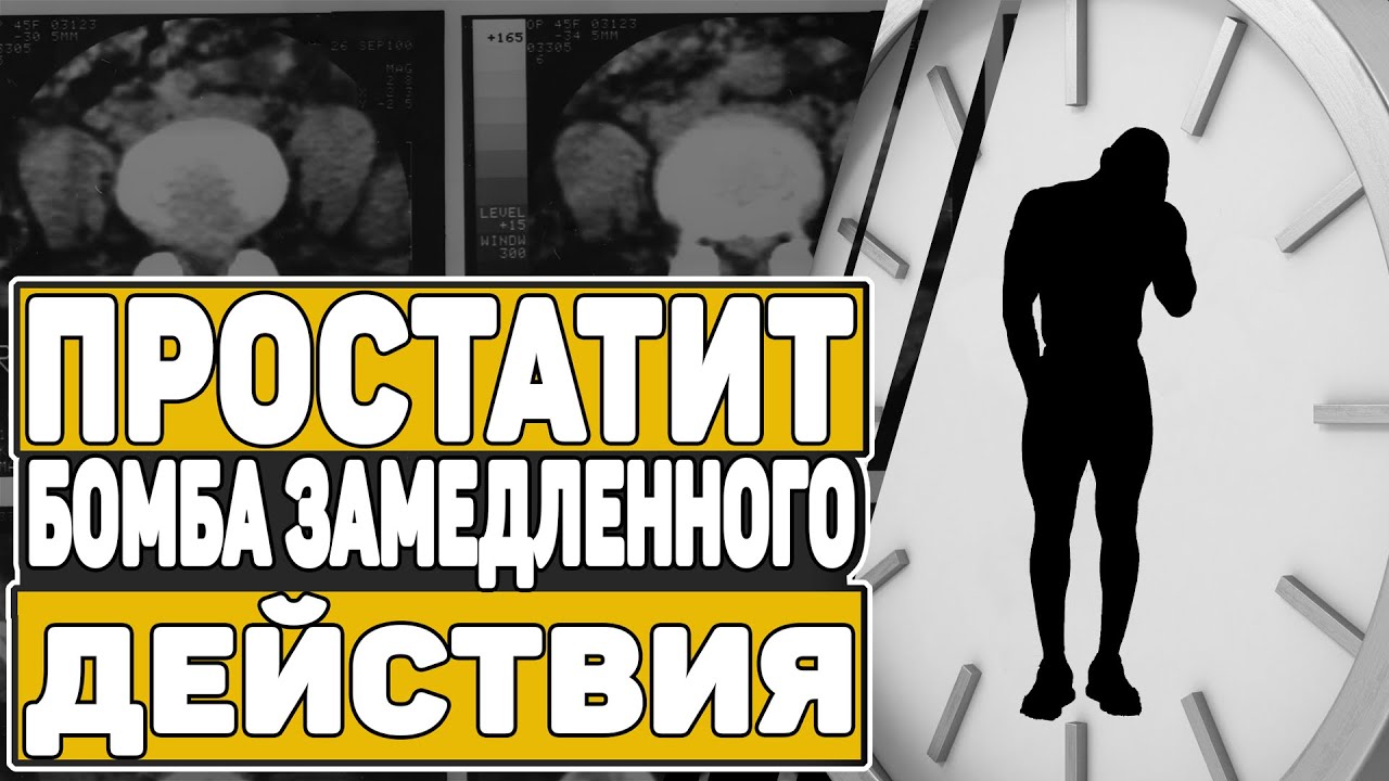ПРОСТАТИТ. СИМПТОМЫ И ЛЕЧЕНИЕ ПРОСТАТИТА. ПРОФИЛАКТИКА ПРОСТАТИТА. (0 ...