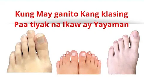 kung May Ganito Kang Paa tiyak Ikaw ay Yayaman