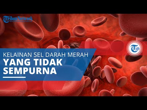 Video: Bolehkah sindrom myelodysplastic disembuhkan?