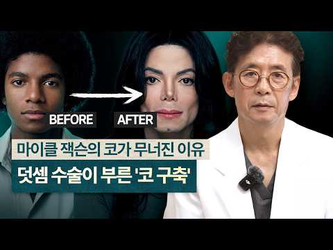 코끝이 들리고 딱딱해진다면? 구축코가 시작되는 신호와 재수술 원칙 이미지