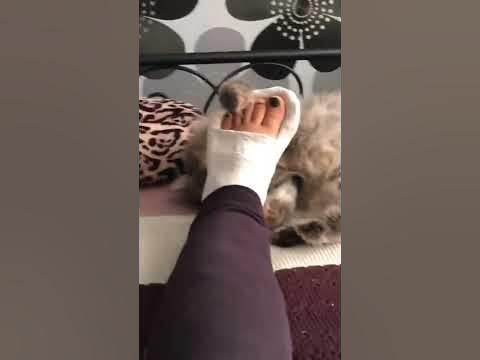 Нога в гипсе_5 - YouTube