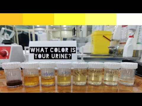 मूत्र रंग भिन्नता | चिकित्सा प्रयोगशाला विज्ञान