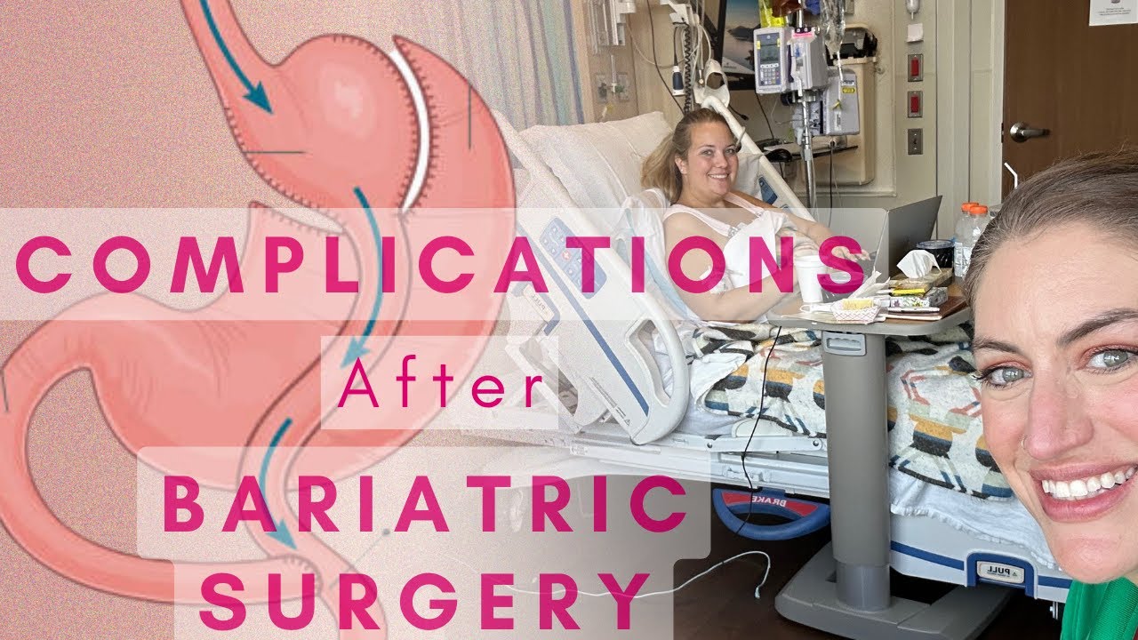 Complications *after* bariatric surgeryAny regrets?! Would she do it