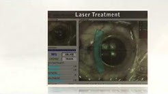 Florida Lasik Surgeon Miami Beach, FL 33139  - Call Now! Braverman Eye Center 