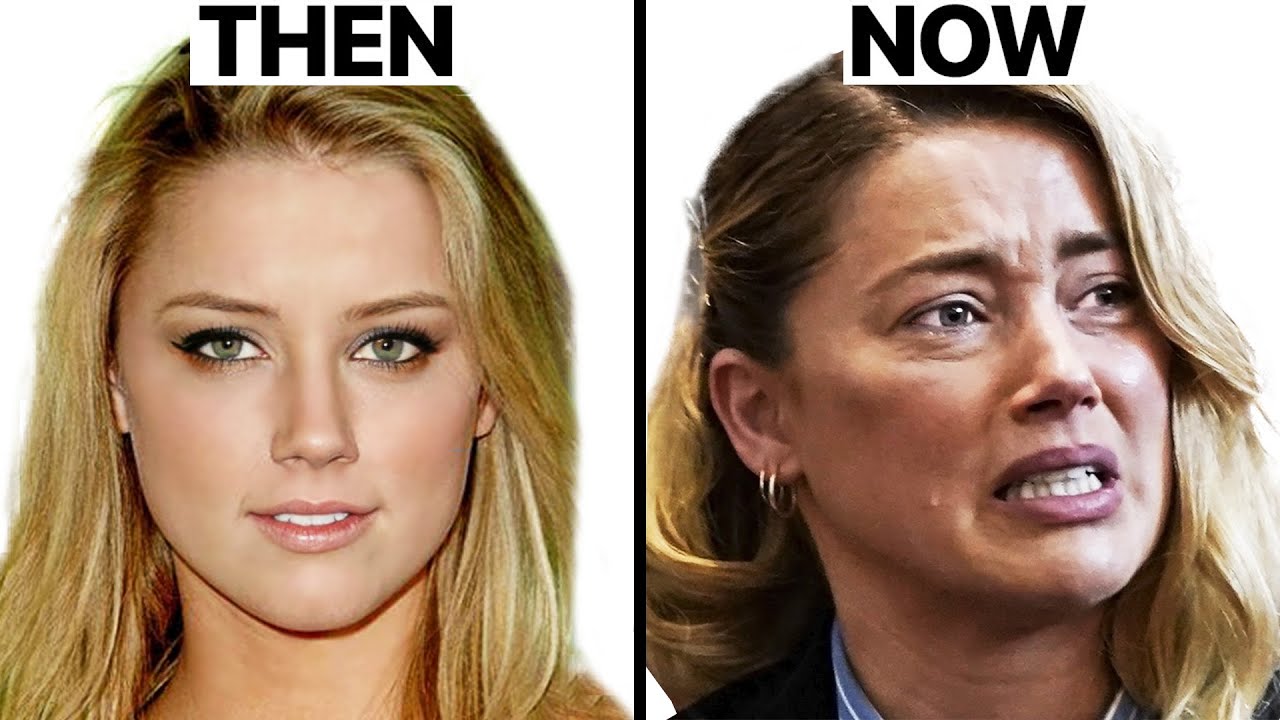 Amber Heard’s New Look – Plastic Surgery Analysis