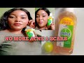 How to use Dettol Antiseptic Liquid and Lemon to get rid of Acne and scar/ Get acne free skin