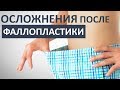 🆘ОСТОРОЖНО! Осложнения после увеличения члена!