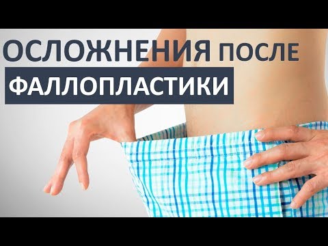 Видео: Фаллопластика: хирургия полового подтверждения FTM, осложнения