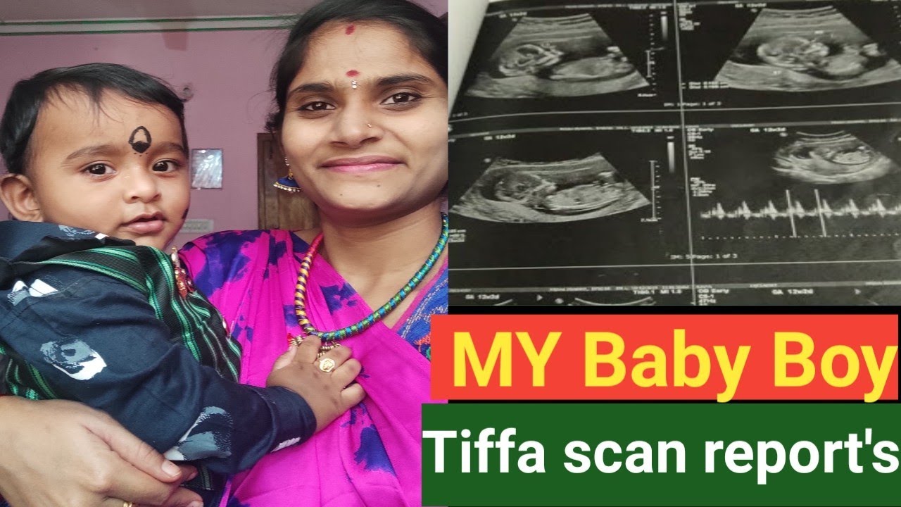 Baby Boy Tiffa Scan Reports anomaly tiffa scan Full Details YouTube baby-boy-tiffa-scan-reports-anomaly-tiffa-scan-full-details-youtube
