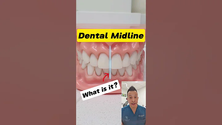 Dental Midline Explained: Alignment and Symmetry #dentallan #dentist #shorts