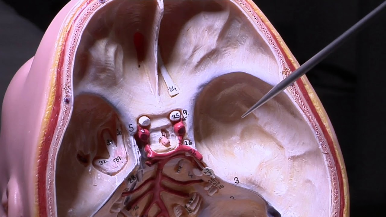 Saint Patrick Hospital HealthBreak - PFO Closure