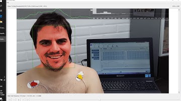 Real-time video pulse detection technology