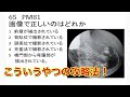 真面目に学ぶ胃透視【診療放射線技師国家試験対策】