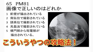 真面目に学ぶ胃透視【診療放射線技師国家試験対策】