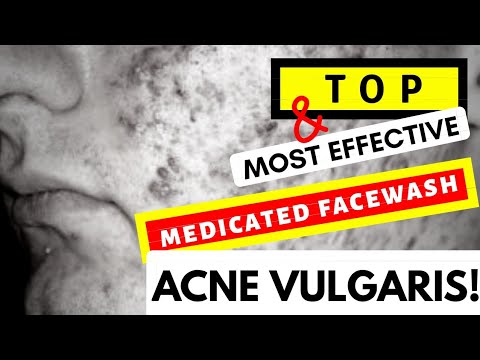 TOP  MEDICATED FACE WASH FOR ACNE VULGARIS (PART ) | CYSTIC ACNE SERIES