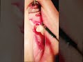 Danton ki jadon ko kaise nikaalte hain#DENTAL🦷