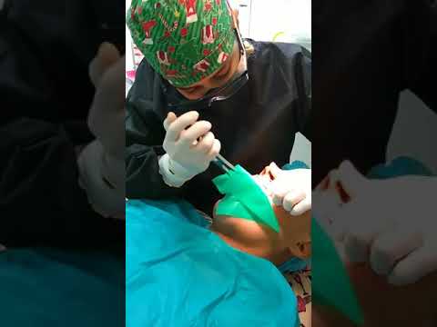 Video: Cómo ir al dentista: 14 pasos (con imágenes)