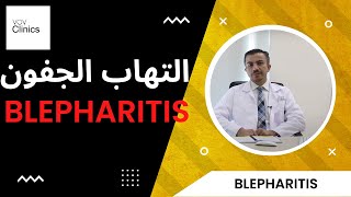 Blepharitis - التهاب جفون العين