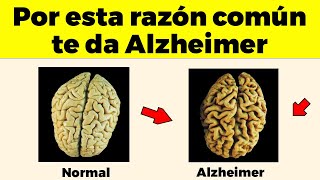 ESTA ES La Causa Nº 1 de ALZHEIMER (demencia) y nadie te avisa