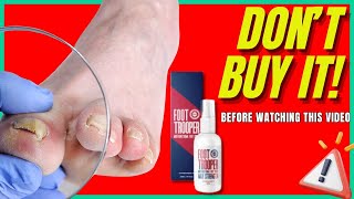 FOOT TROOPER FUNGAL TREATMENT BY FOOT TROOPER FOOT TROOPER SPRAY - Foot  Trooper Review 