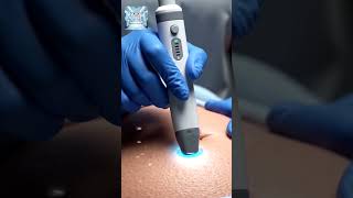 How Ultrasound Works | Inside Body Imaging Without Radiation
