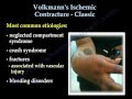 Volkmann's Ischemic Contracture Classic - Everything You Need To Know - Dr. Nabil Ebraheim