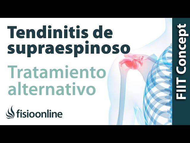 Dolor fuerte de hombro izquierdo