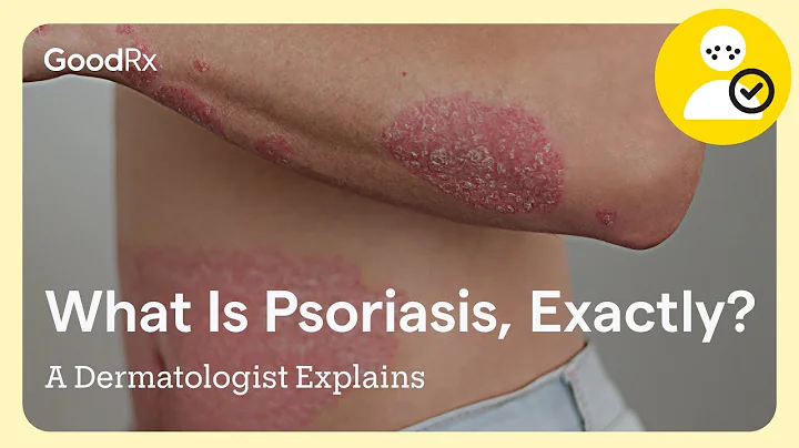 What Is Psoriasis, Exactly? A Dermatologist Explains | GoodRx