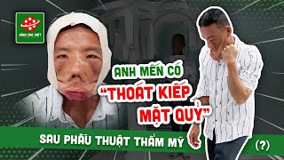 [TOÀN CẢNH] “Giải cứu gương mặt” cho CHÀNG TRAI MẶT QUỶ (Phần 1) cùng Phong Bụi đến Bệnh viện JW