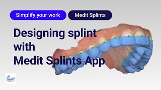 Designing splint with Medit Splints app