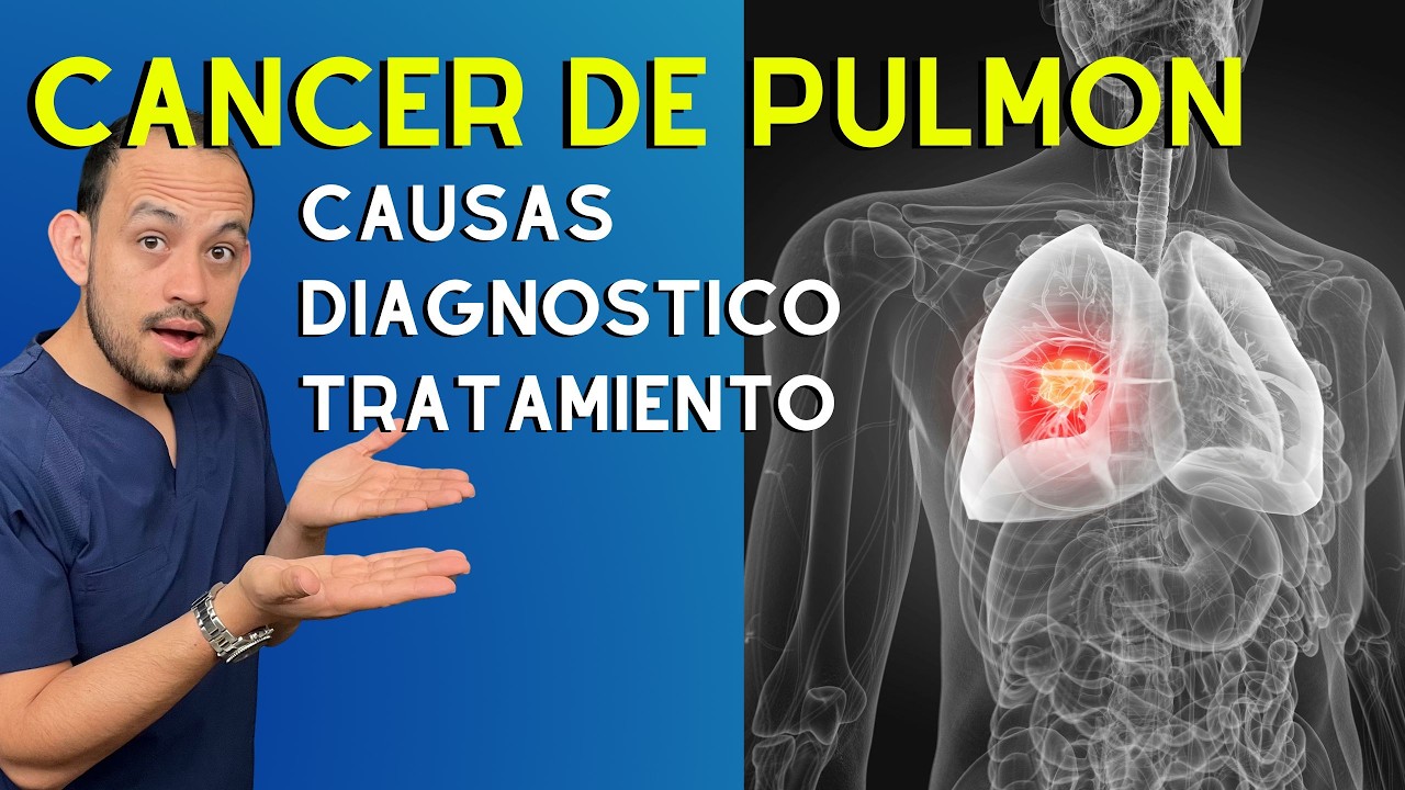 Cáncer de Pulmón: Causas, Diagnóstico y Tratamiento | Dr. Francisco ...