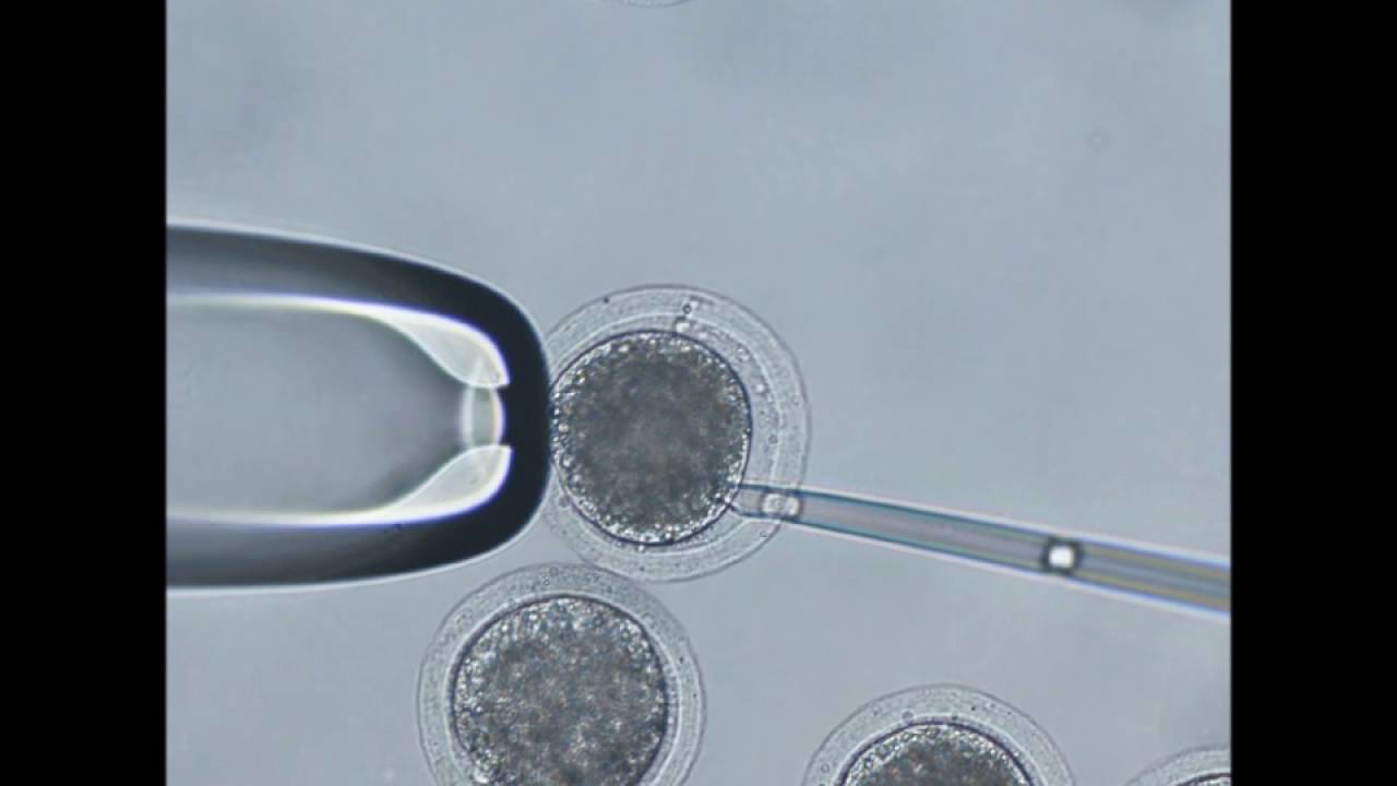 somatic cell nuclear transfer scnt injection youtube somatic cell nuclear transfer