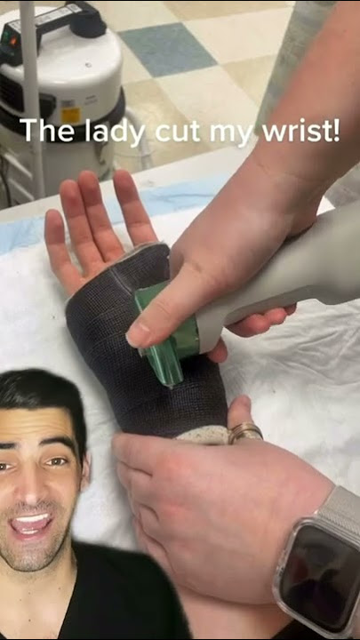 Cast removal after fracture