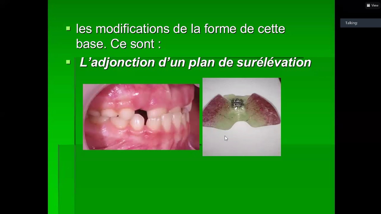 La therapeutique amovible