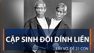 Cặp sinh đôi dính liền lấy vợ, đẻ 21 con | VTC1