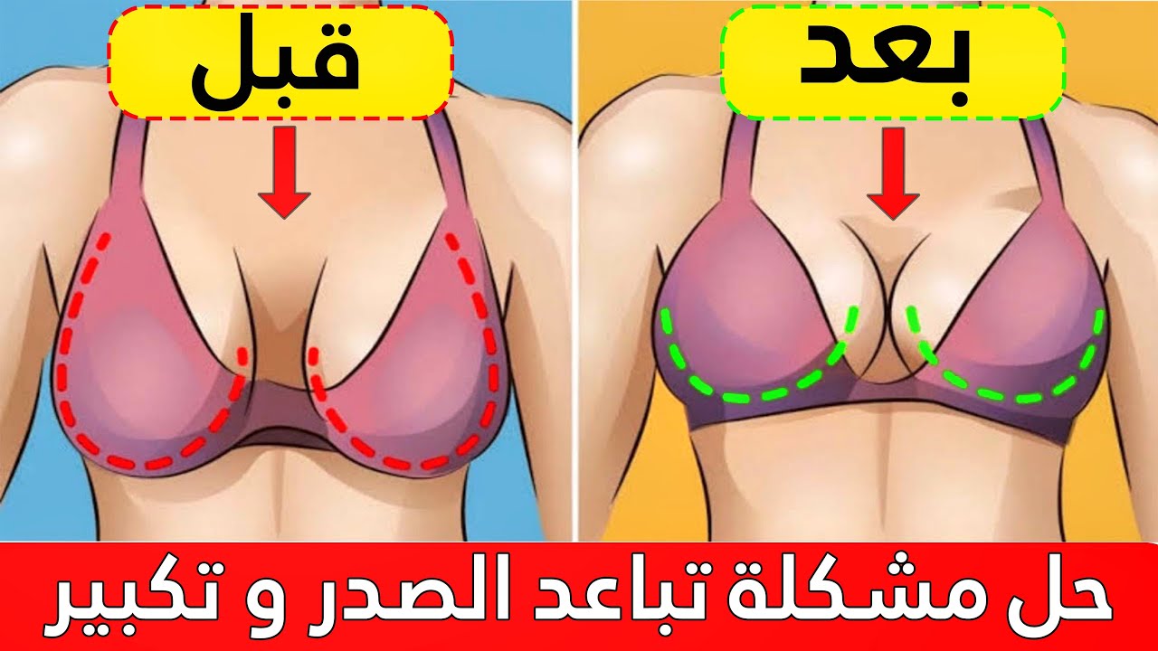 حل مشكلة تباعد الصدر بتمرين سهل جدا مع شد ورفع في 15 يوم [ كيف تحصلين على صدر مثالي... ]