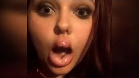 Teens Suffer Crazy Injuries Attempting 'Kylie Jenner Lip Challenge'