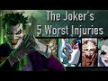 The Joker's 5 Worst Injuries (That Didn't Kill Him)