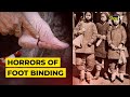 Beauty Standards and Painful Traditions in History