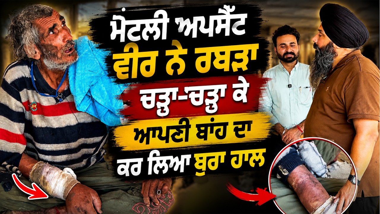 ⁣ਮੈਂਟਲੀ ਅਪਸੈੱਟ ਵੀਰ ਨੇ ਰਬੜਾ ਚੜ੍ਹਾ-ਚੜ੍ਹਾ ਕੇ ਆਪਣੀ ਬਾਂਹ ਦਾ ਕਰ ਲਿਆ ਬੁਰਾ ਹਾਲ