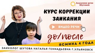 Лечение заикания у детей. Ясмина 4 года. Речь до и после.(, 2016-03-13T16:42:00.000Z)