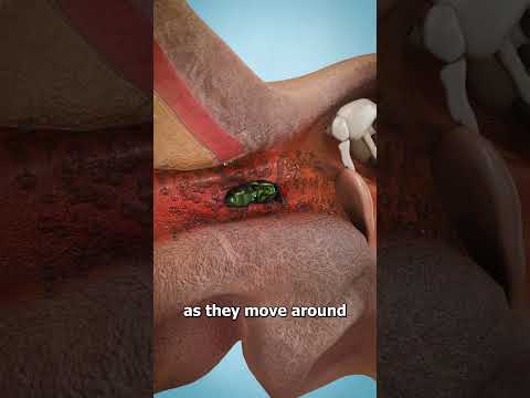 What Insects Fly In Ears
