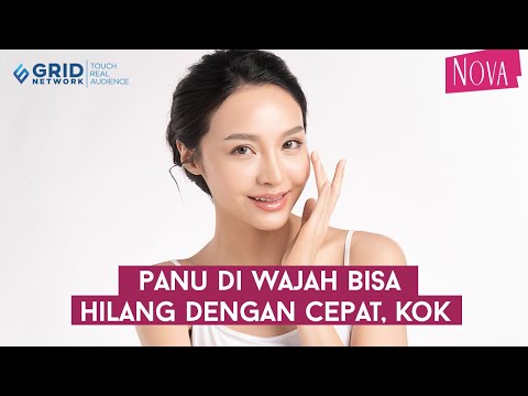 Cara Menghilangkan Bekas Jamur Di Wajah