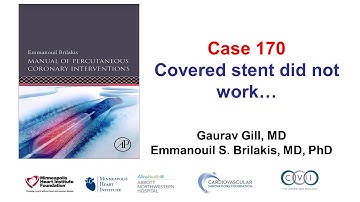 Case 170: Manual of PCI - Covered stent did not work
