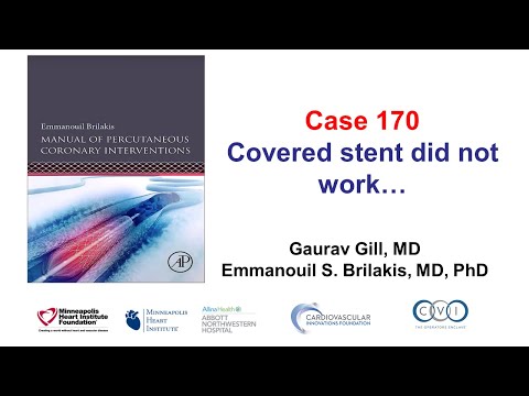 Case 170: Manual of PCI - Covered stent did not work