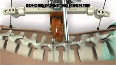 Mazor Robotics