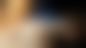 Arthrex plate 5th metatarsal base fracture surgical repair`