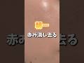 赤み消し去る！