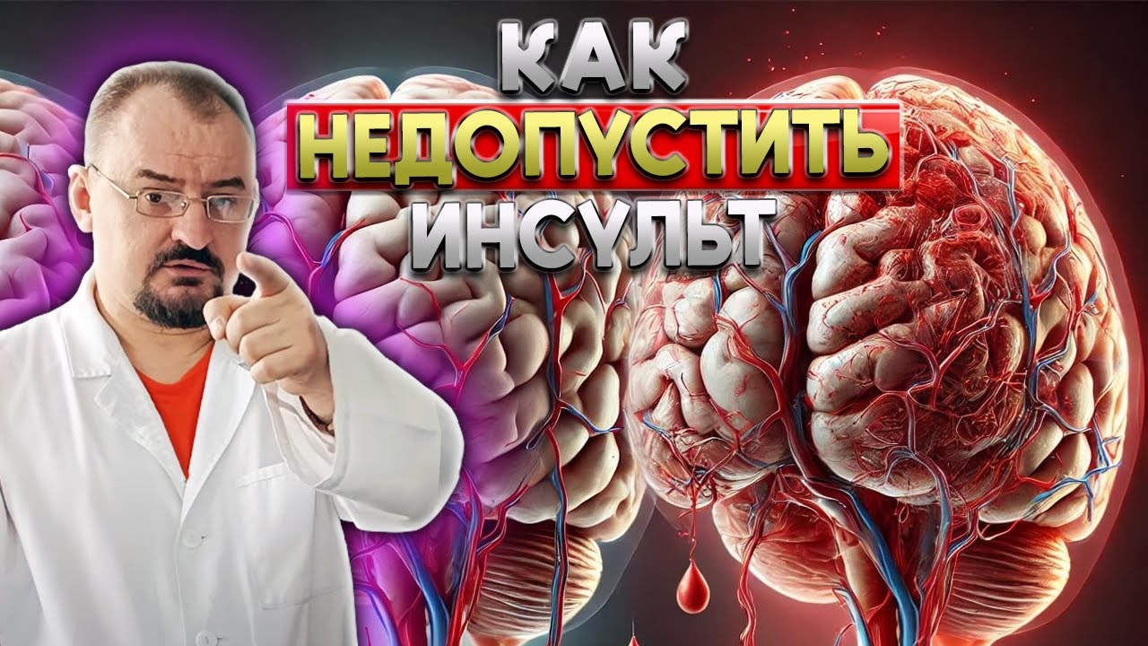 Инсульт: как защититься и восстановиться?