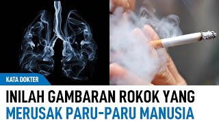 Bagaimana Rokok Dapat Merusak Paru-Paru Manusia? Seperti Ini Gambarannya! | Kata Dokter